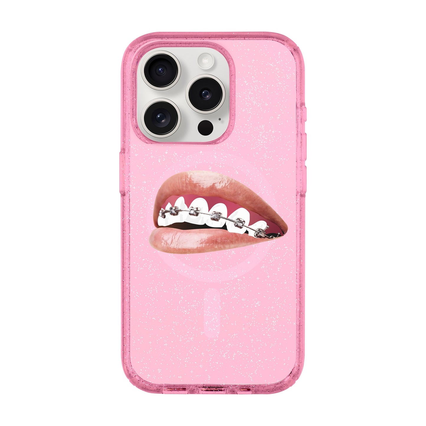 ORTHODONTIST-iPhone 15 Pro Shiny Kılıf MagSafe Özellikli