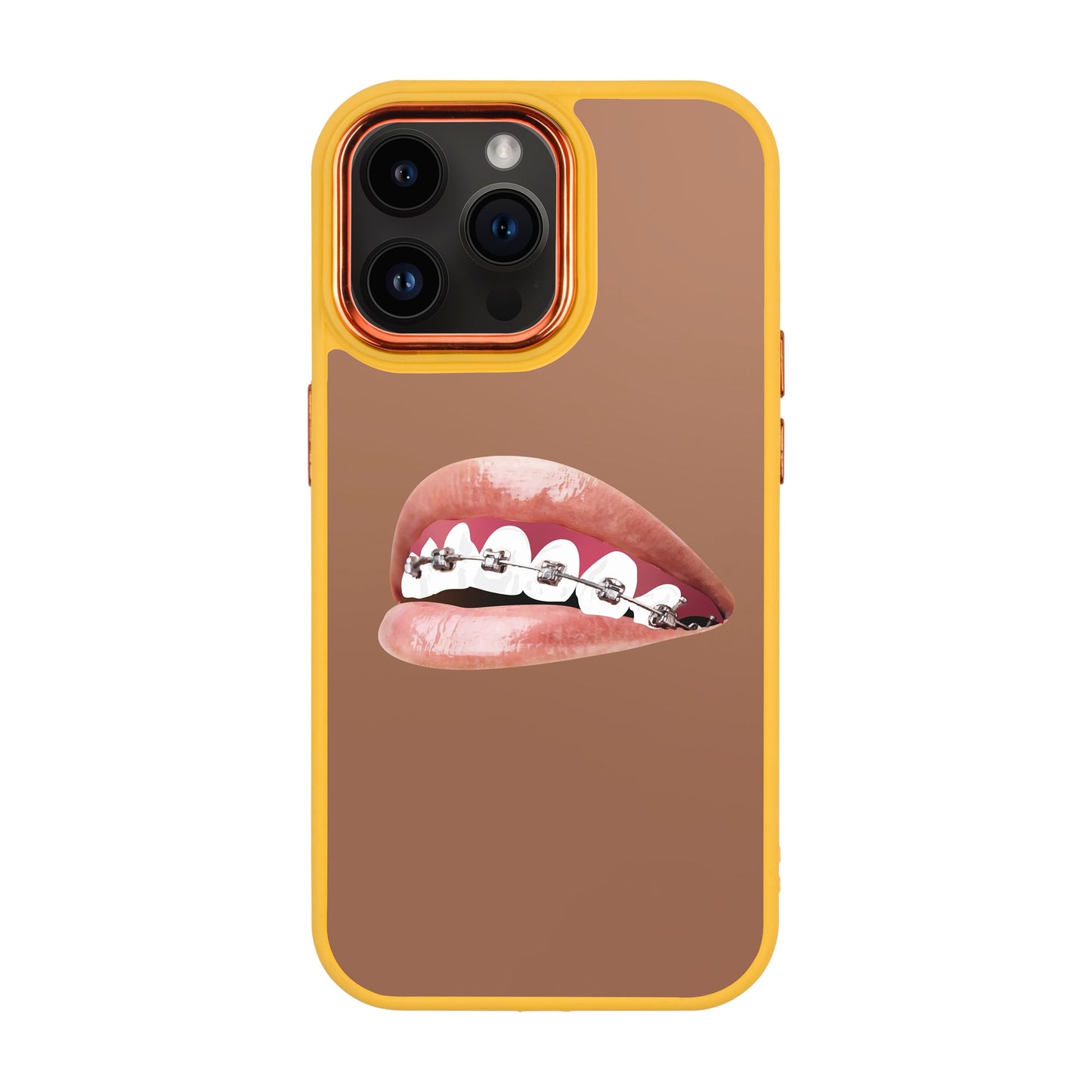 ORTHODONTIST-iPhone 14 Pro Max Proof Kılıf