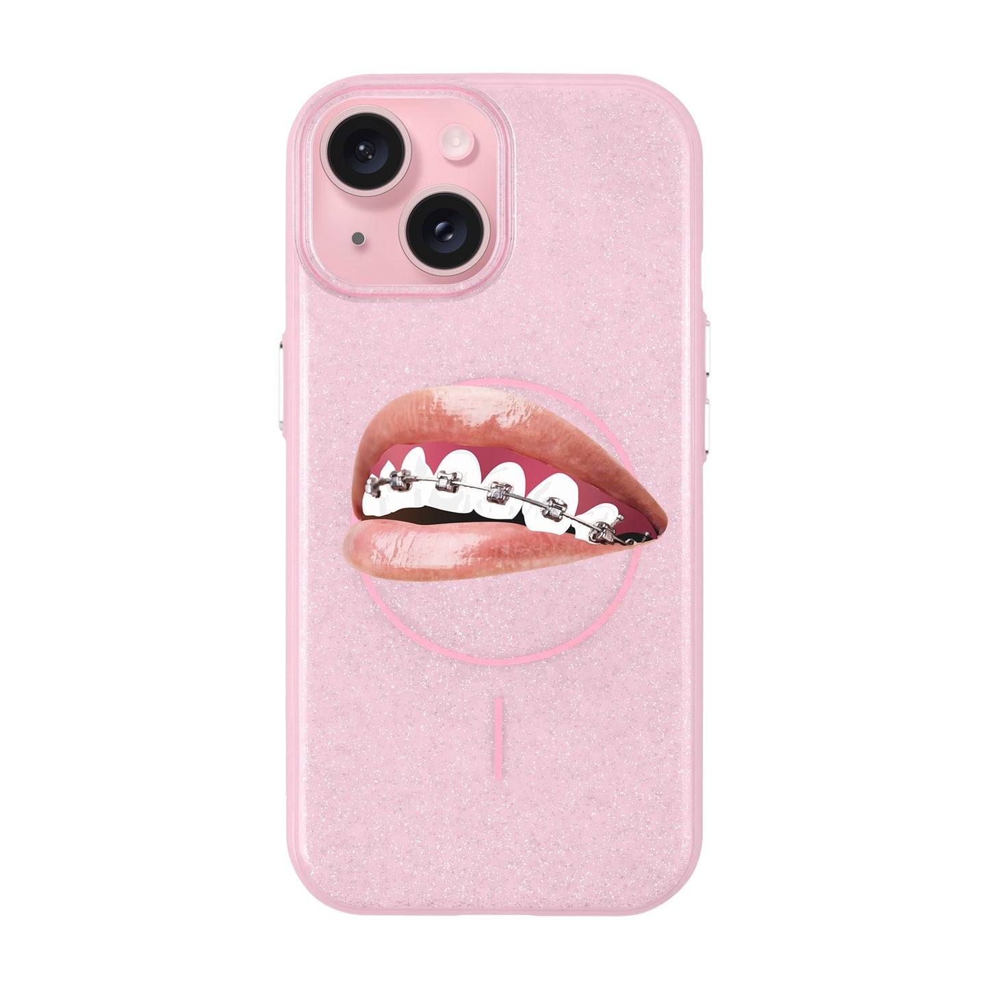 ORTHODONTIST-iPhone 15 Plus Radiant Kılıf MagSafe Özellikli