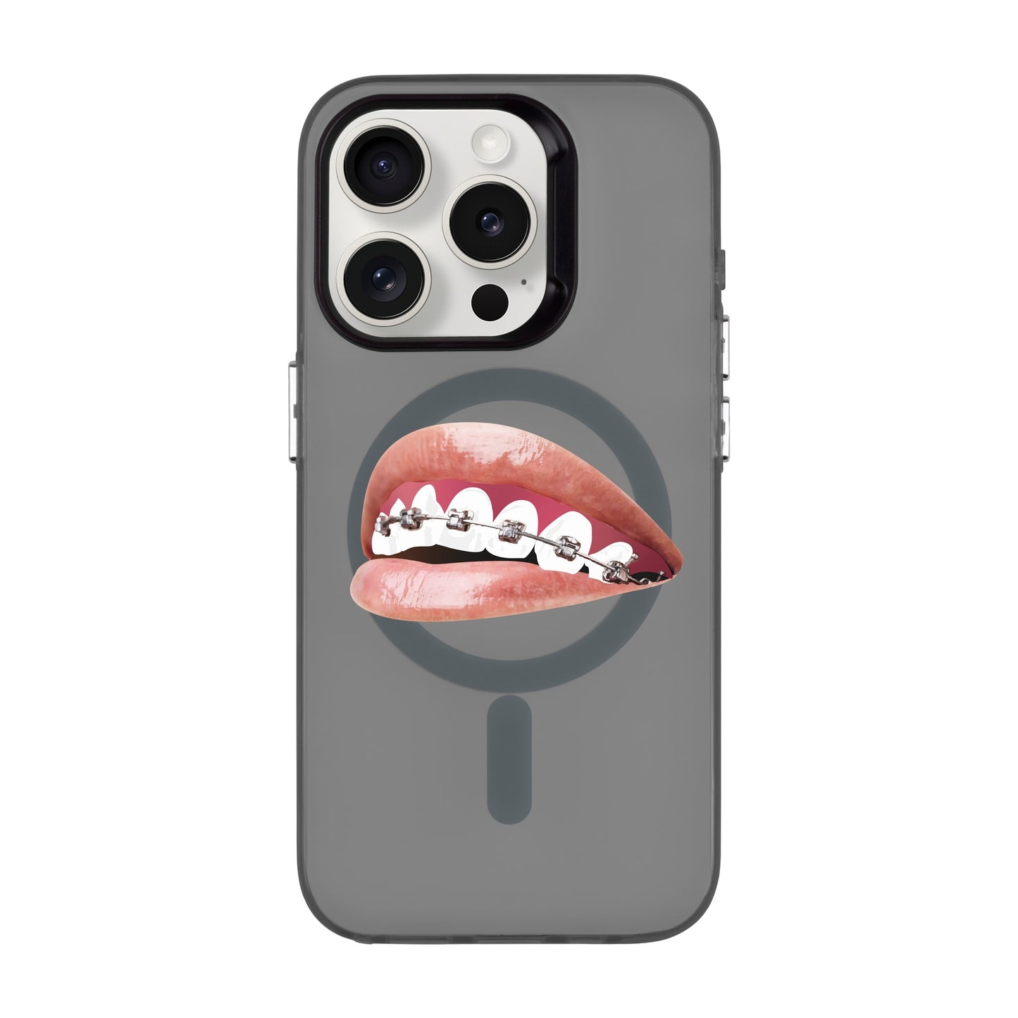 ORTHODONTIST-iPhone 15 Pro Hold Kılıf MagSafe Özellikli