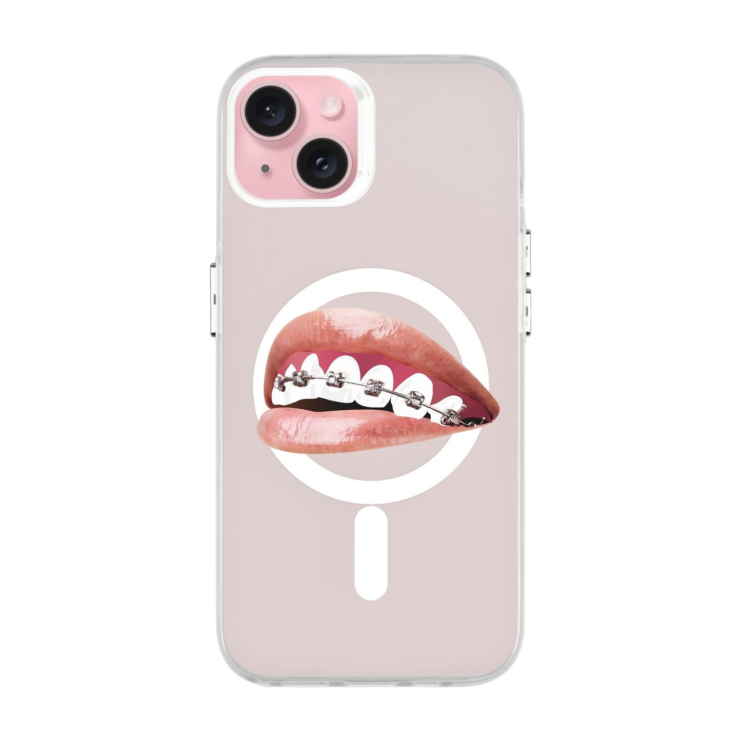 ORTHODONTIST-iPhone 15 Plus Hold Kılıf MagSafe Özellikli
