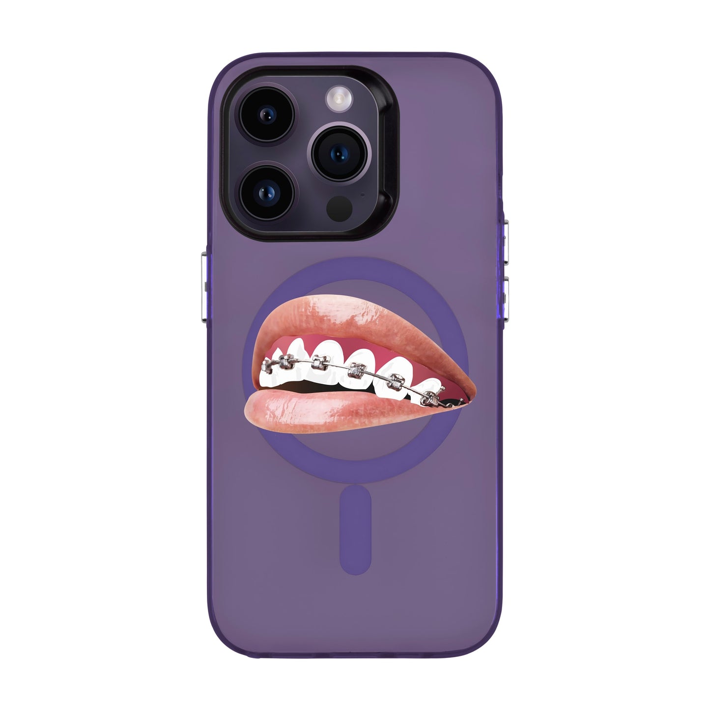 ORTHODONTIST-iPhone 14 Pro Hold Kılıf MagSafe Özellikli