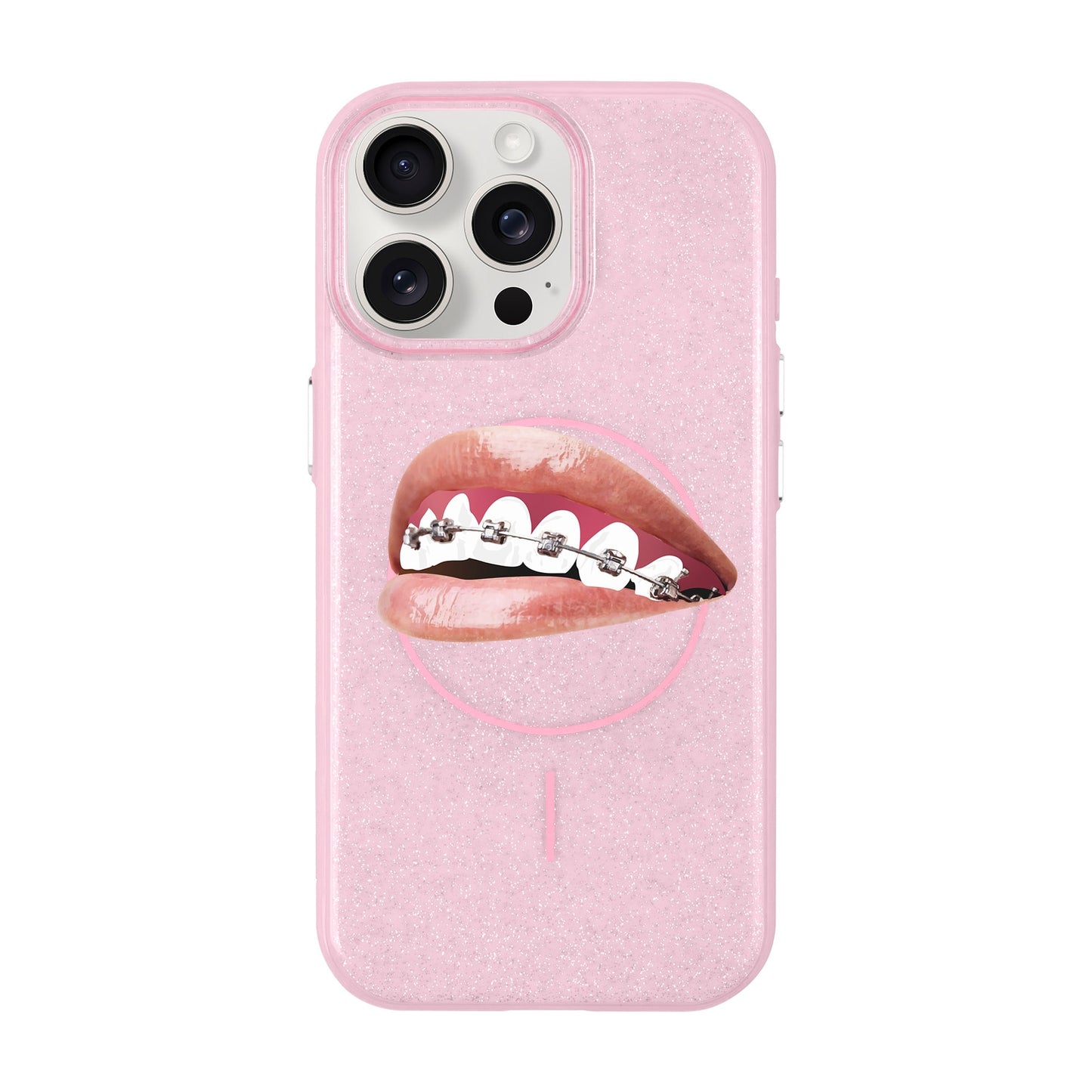 ORTHODONTIST-iPhone 15 Pro Max Radiant Kılıf MagSafe Özellikli