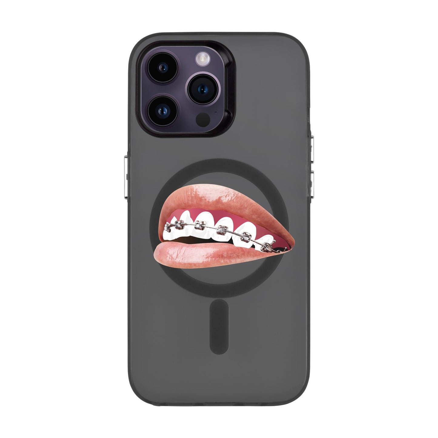ORTHODONTIST-iPhone 14 Pro Max Hold Kılıf MagSafe Özellikli