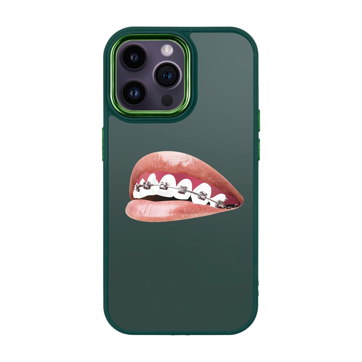 ORTHODONTIST-iPhone 14 Pro Max Proof Kılıf