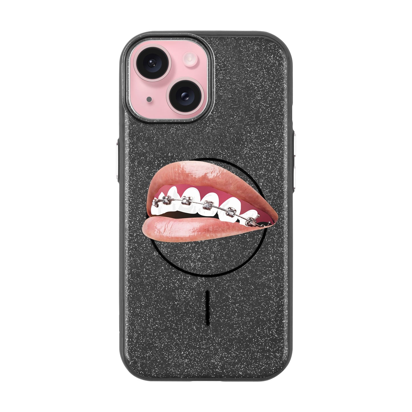 ORTHODONTIST-iPhone 15 Plus Radiant Kılıf MagSafe Özellikli