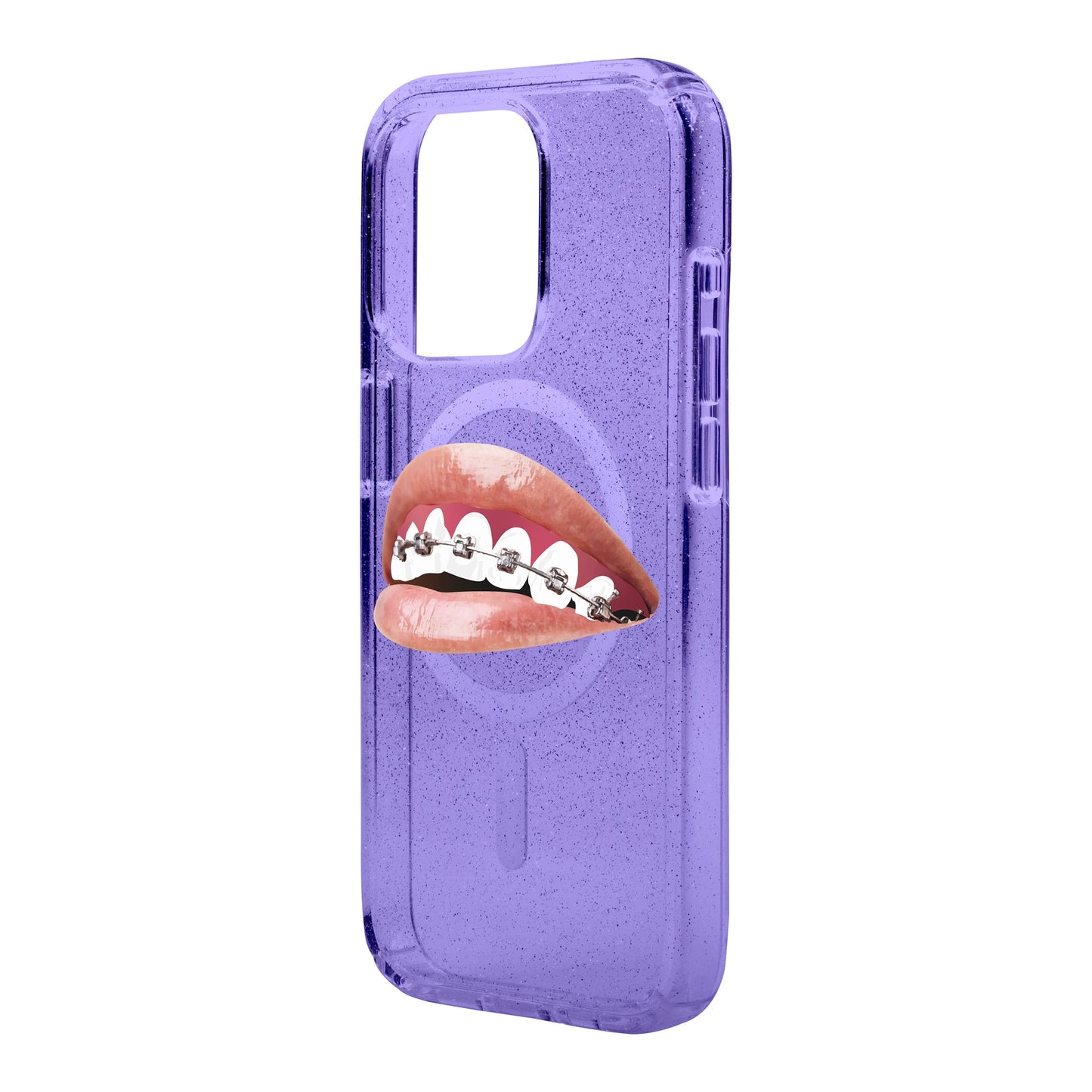 ORTHODONTIST-iPhone 15 Pro Max Shiny Kılıf MagSafe Özellikli