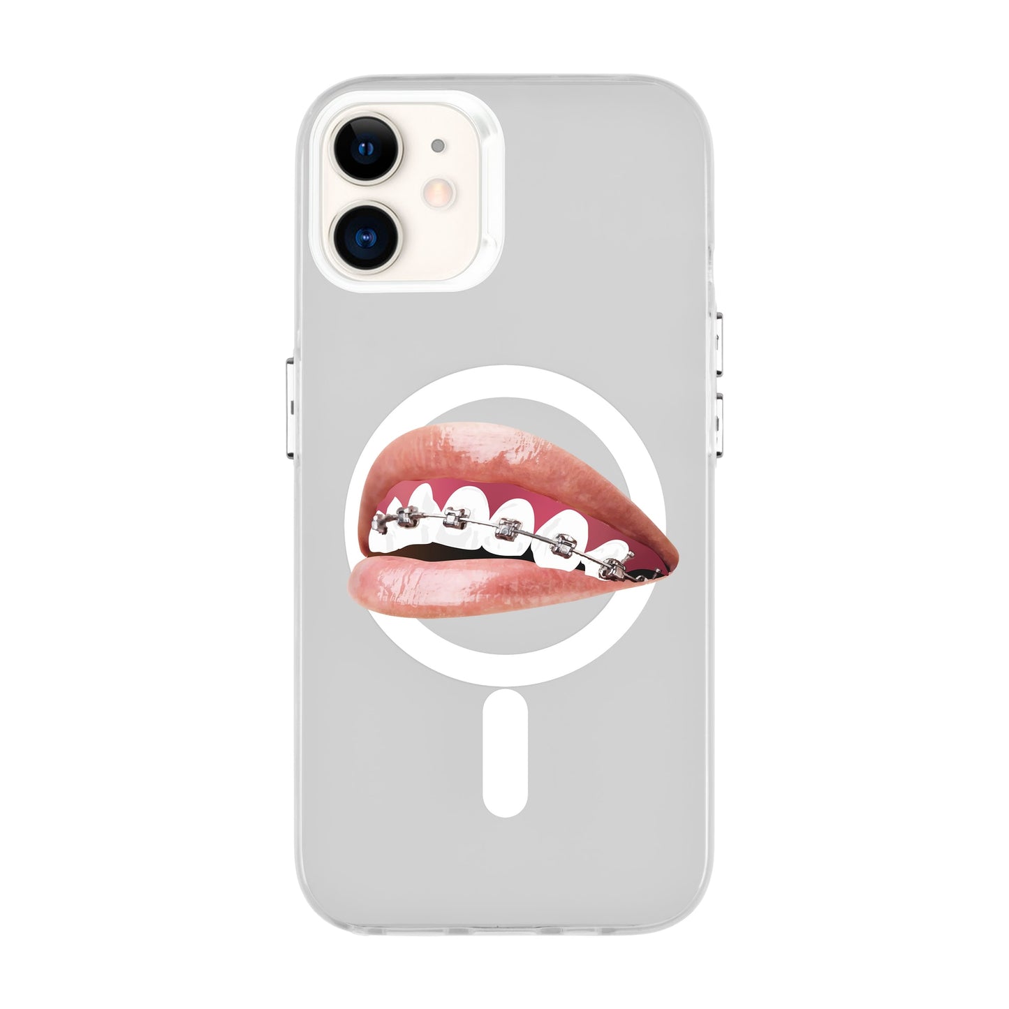 ORTHODONTIST-iPhone 11 Hold Kılıf MagSafe Özellikli