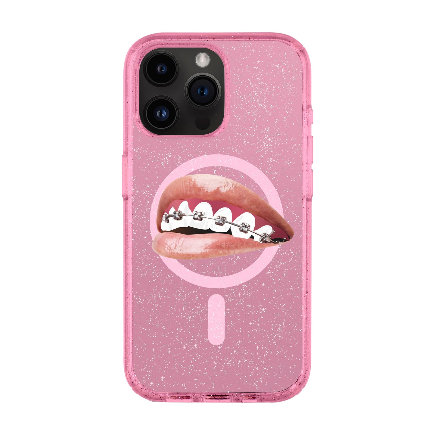ORTHODONTIST-iPhone 14 Pro Max Shiny Kılıf MagSafe Özellikli
