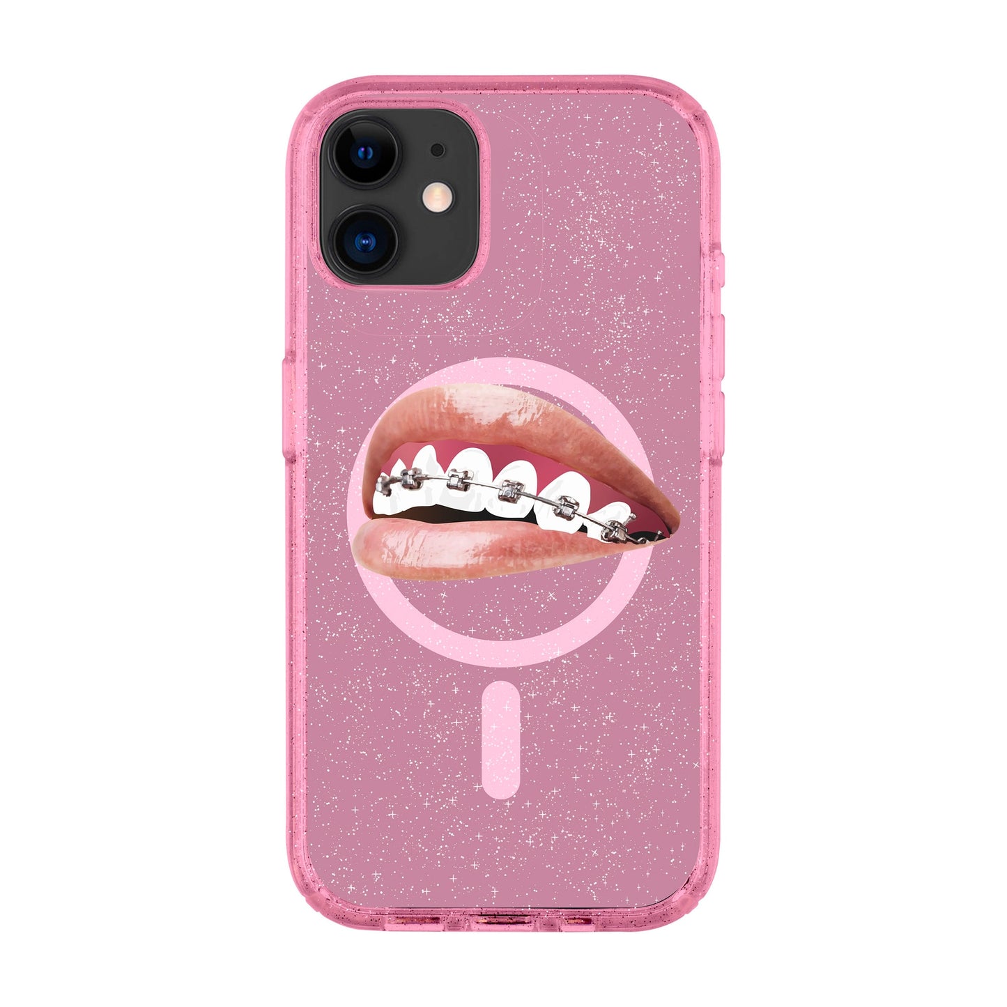 ORTHODONTIST-iPhone 11 Shiny Kılıf MagSafe Özellikli