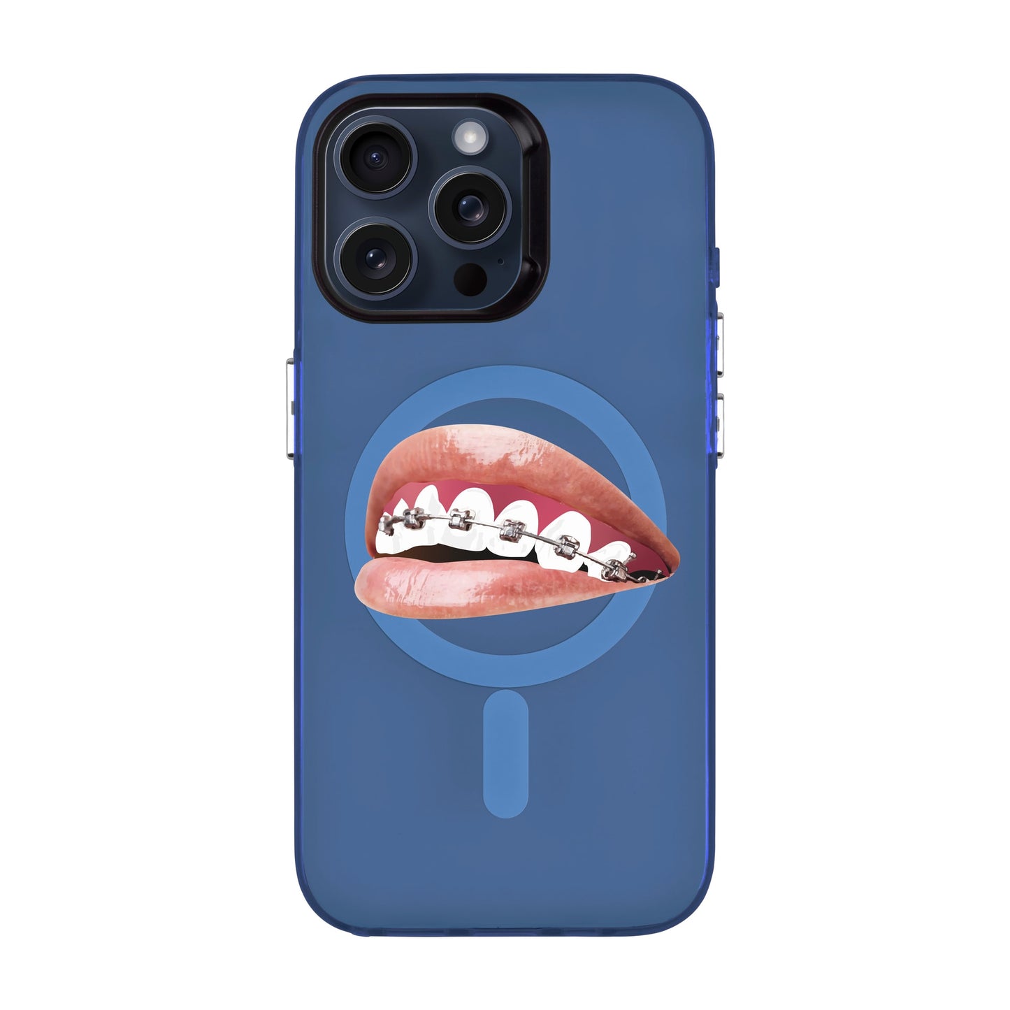 ORTHODONTIST-iPhone 15 Pro Max Hold Kılıf MagSafe Özellikli
