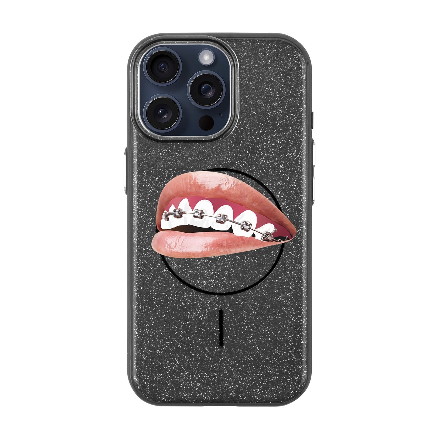 ORTHODONTIST-iPhone 15 Pro Max Radiant Kılıf MagSafe Özellikli