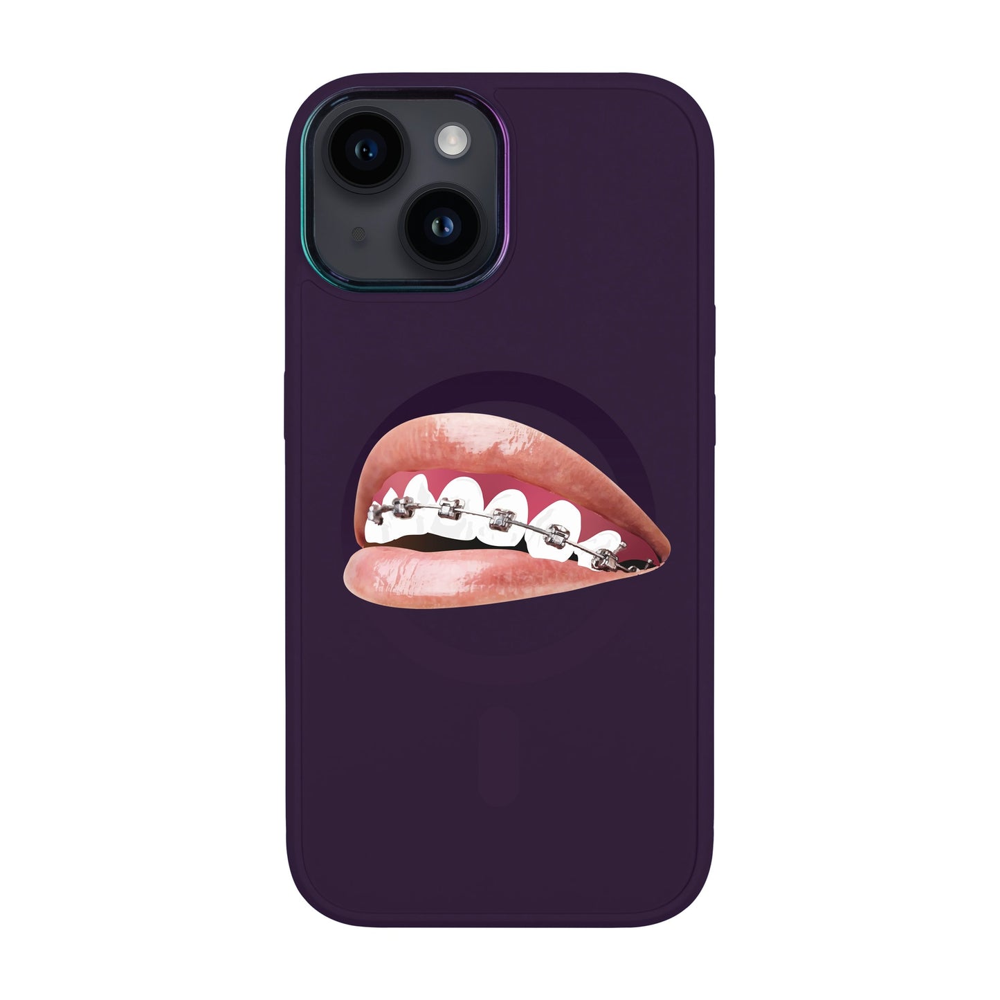 ORTHODONTİST-iPhone 12 Vigor Kılıf MagSafe Özellikli
