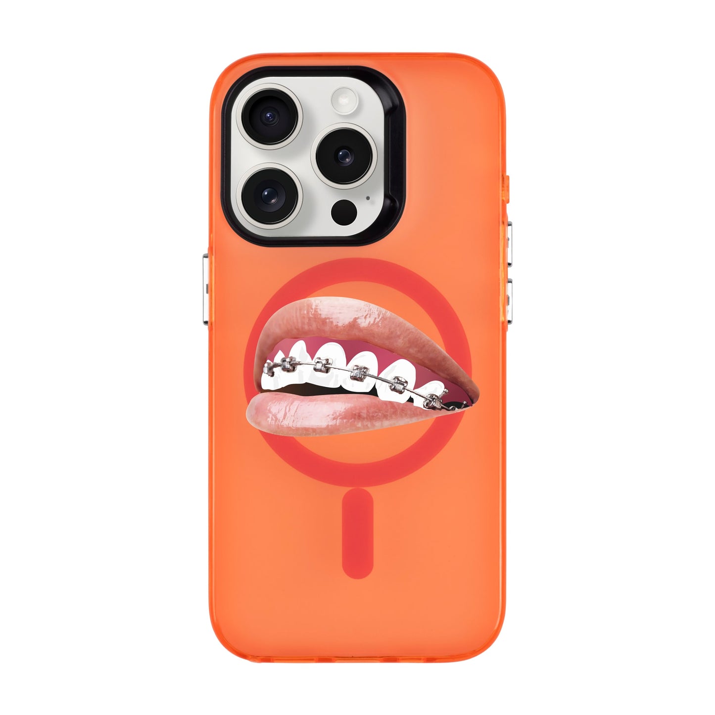 ORTHODONTIST-iPhone 15 Pro Hold Kılıf MagSafe Özellikli