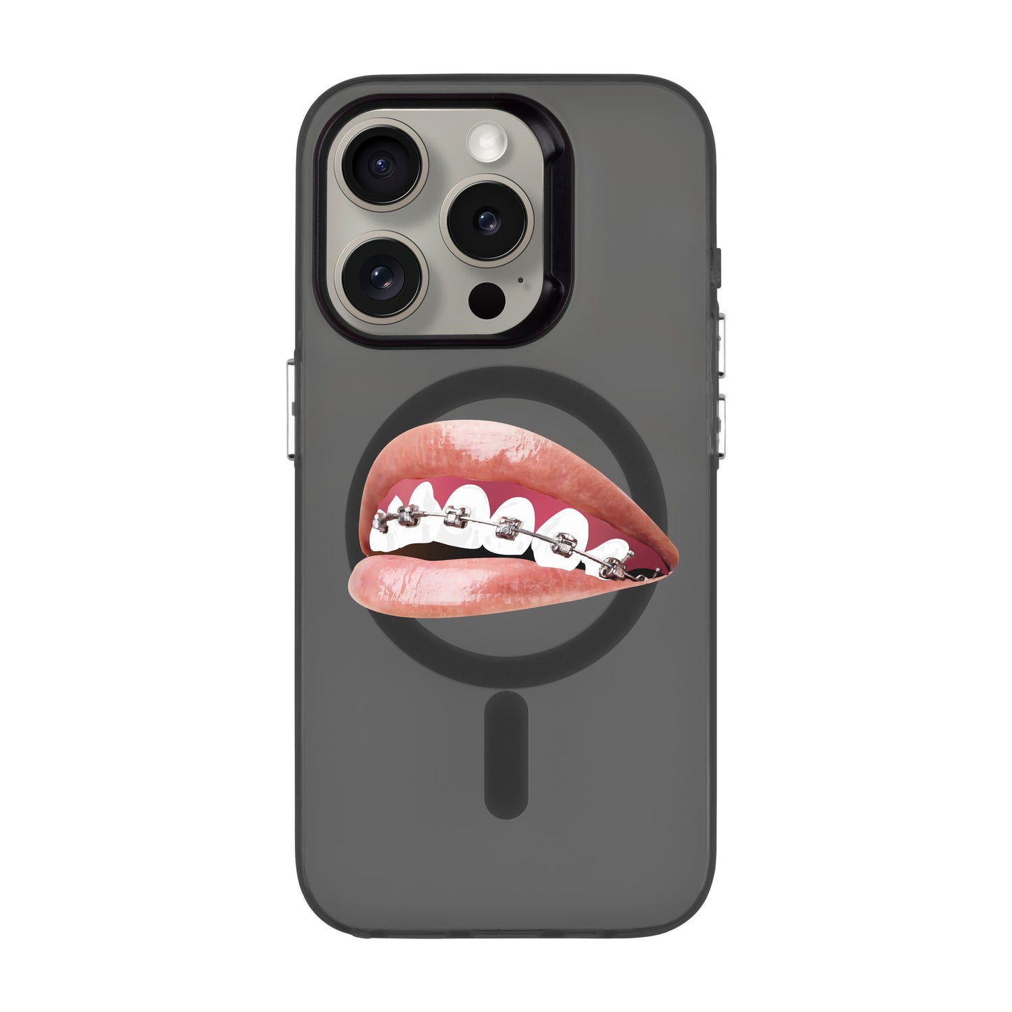 ORTHODONTIST-iPhone 15 Pro Hold Kılıf MagSafe Özellikli