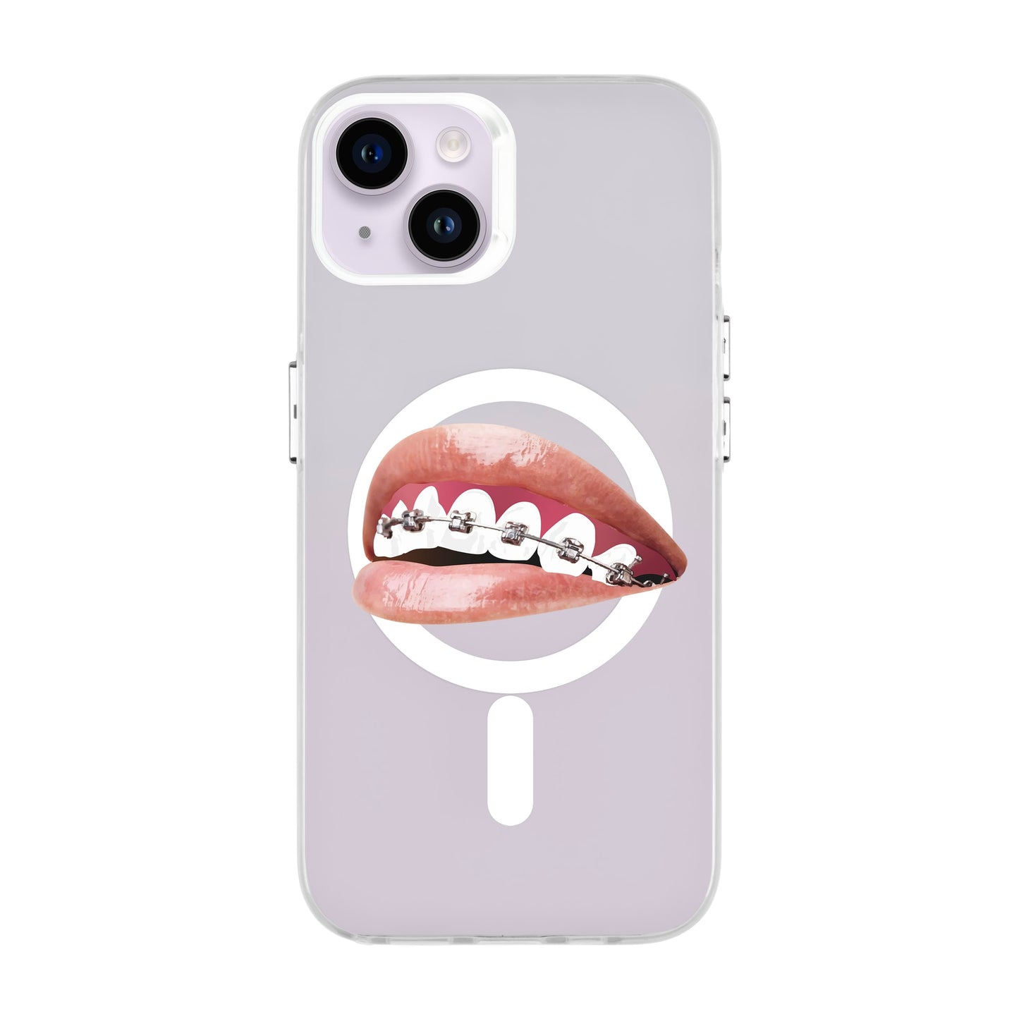 ORTHODONTIST-iPhone 14 Plus Hold Kılıf MagSafe Özellikli