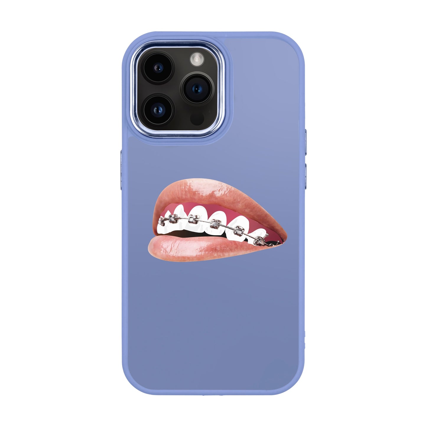 ORTHODONTIST-iPhone 14 Pro Max Proof Kılıf