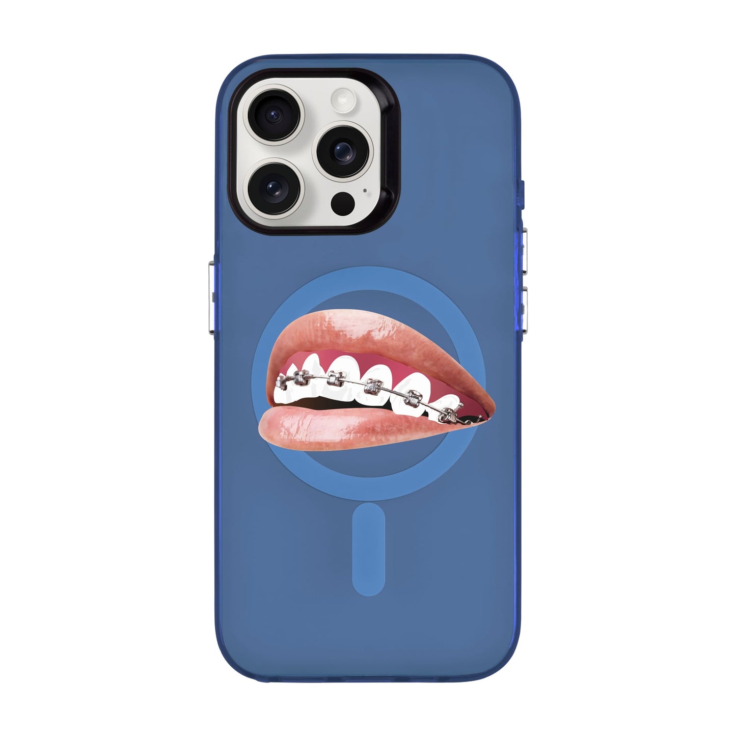 ORTHODONTIST-iPhone 15 Pro Max Hold Kılıf MagSafe Özellikli