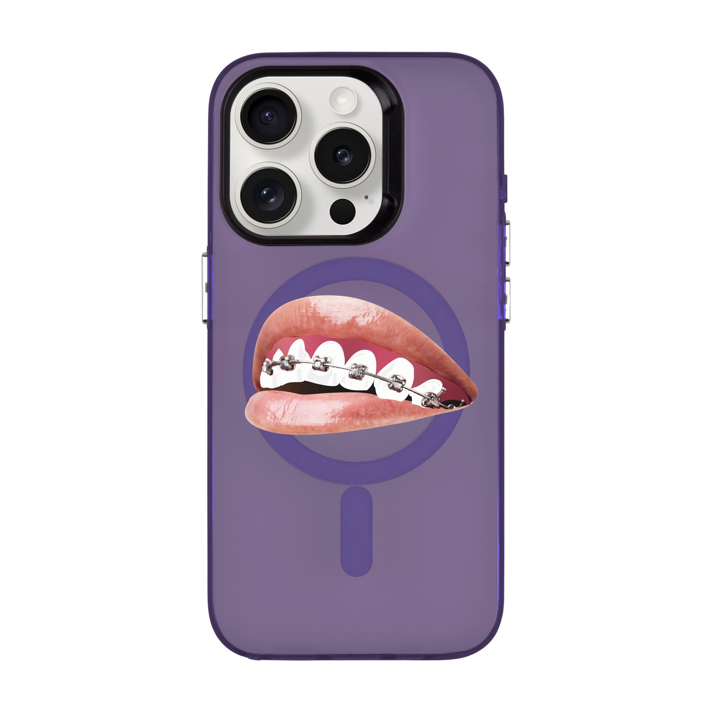 ORTHODONTIST-iPhone 15 Pro Hold Kılıf MagSafe Özellikli