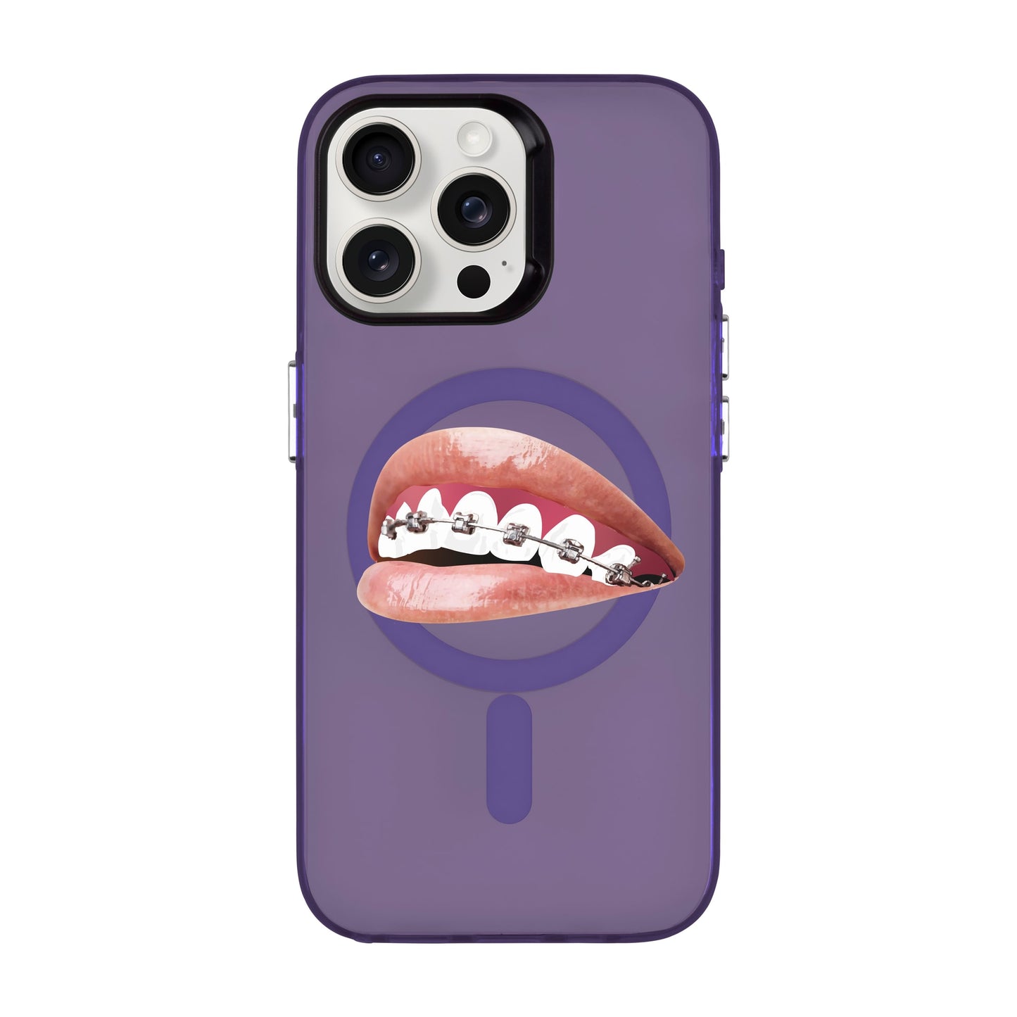 ORTHODONTIST-iPhone 15 Pro Max Hold Kılıf MagSafe Özellikli