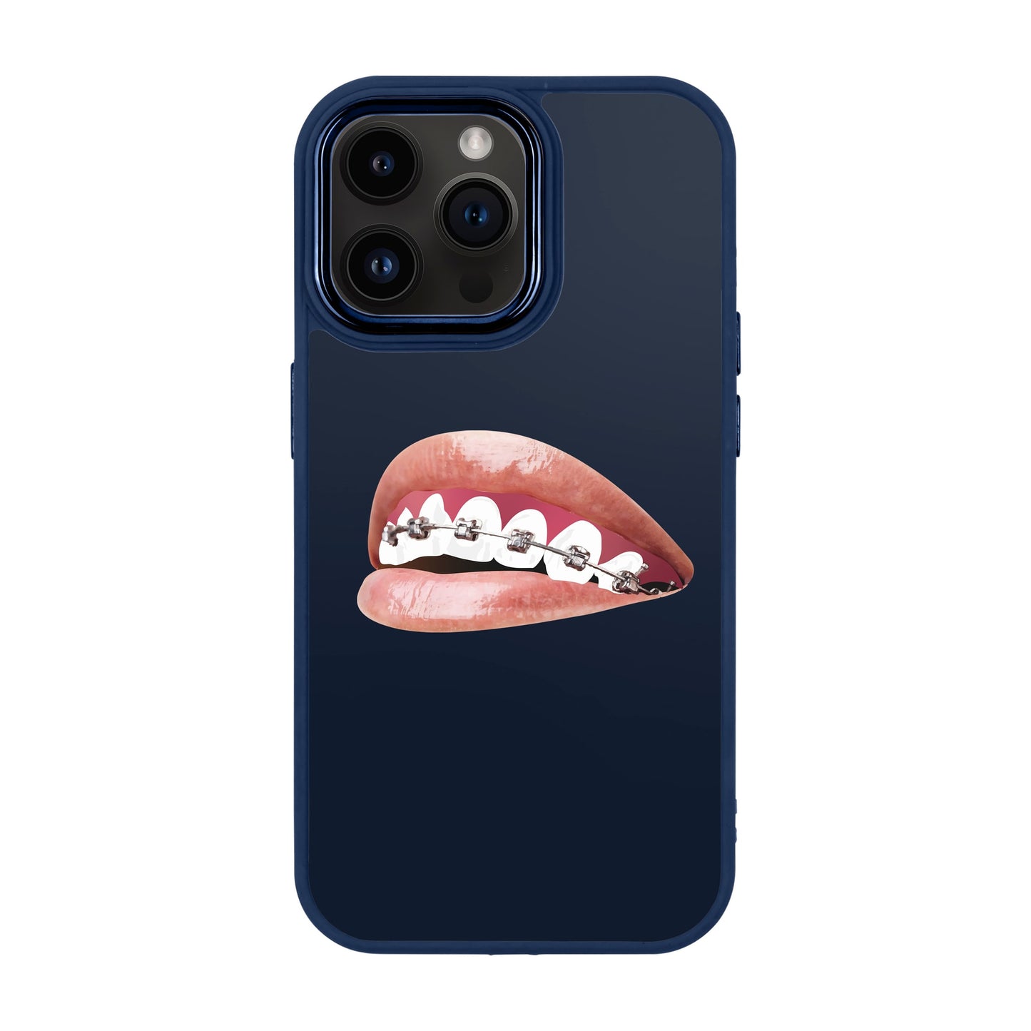 ORTHODONTIST-iPhone 14 Pro Max Proof Kılıf