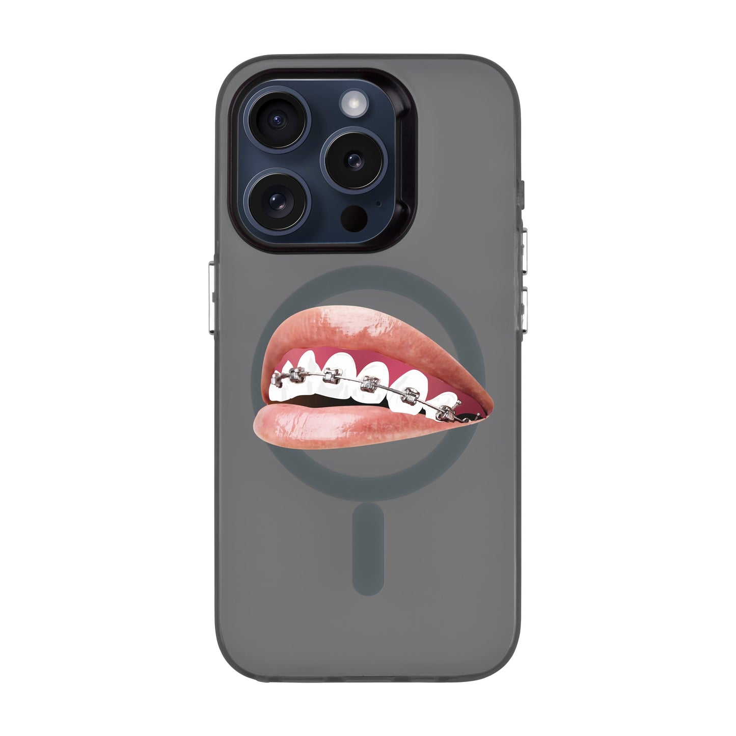 ORTHODONTIST-iPhone 15 Pro Hold Kılıf MagSafe Özellikli