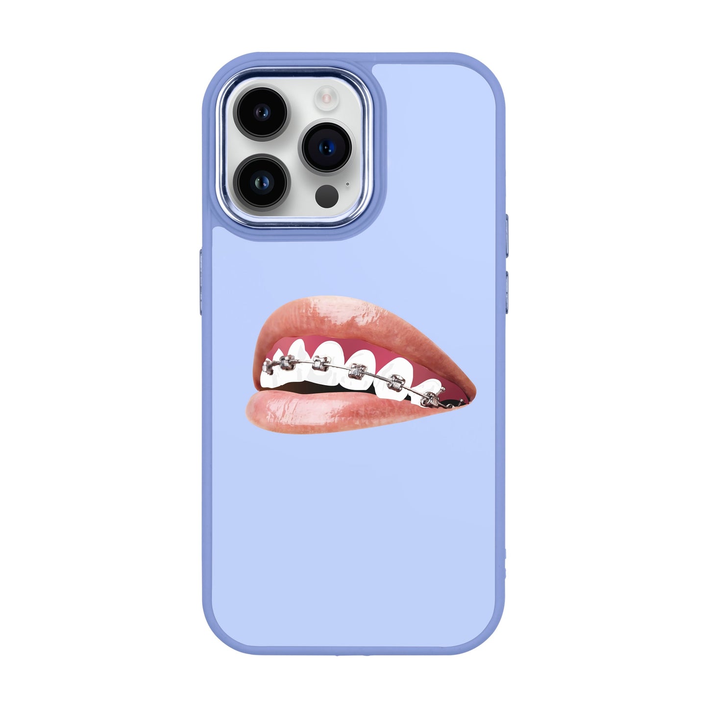 ORTHODONTIST-iPhone 14 Pro Max Proof Kılıf