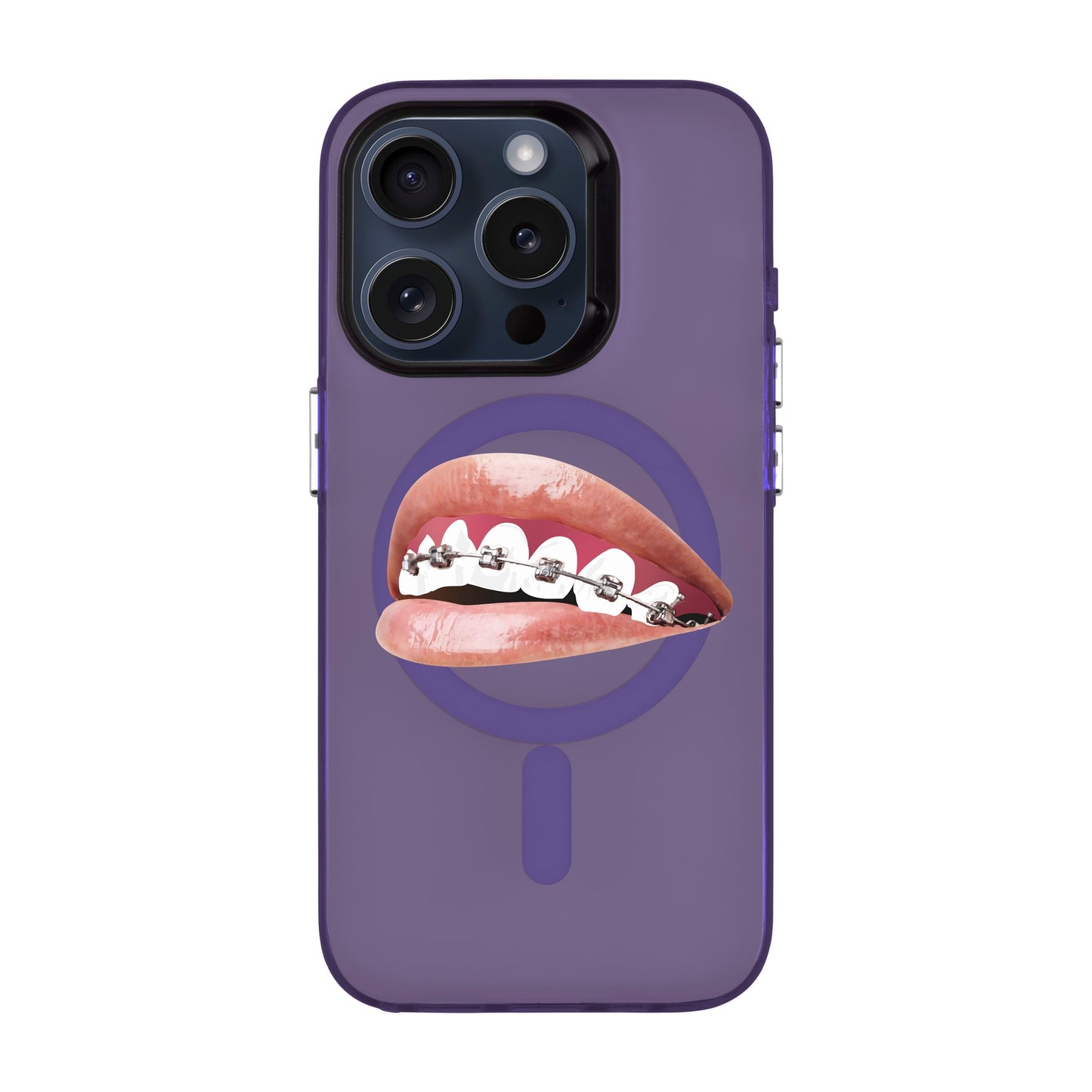 ORTHODONTIST-iPhone 15 Pro Hold Kılıf MagSafe Özellikli