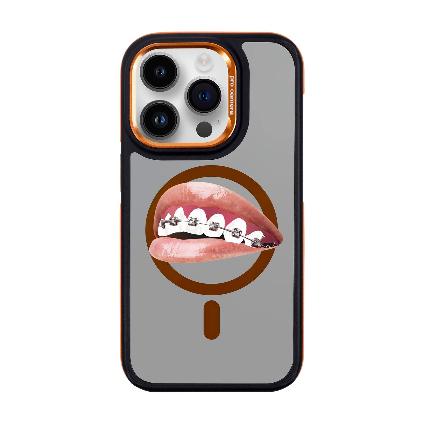 ORTHODONTIST-iPhone 14 Pro Dark Kılıf MagSafe Özellikli
