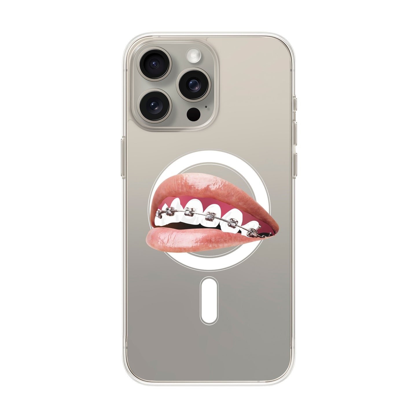ORTHODONTIST-iPhone 15 Pro Max Solid Kılıf MagSafe Özellikli