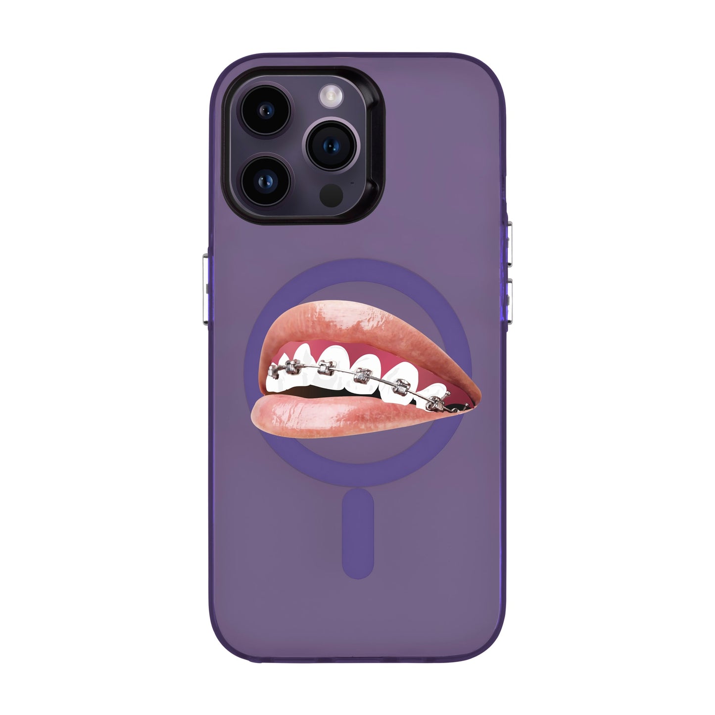 ORTHODONTIST-iPhone 14 Pro Max Hold Kılıf MagSafe Özellikli