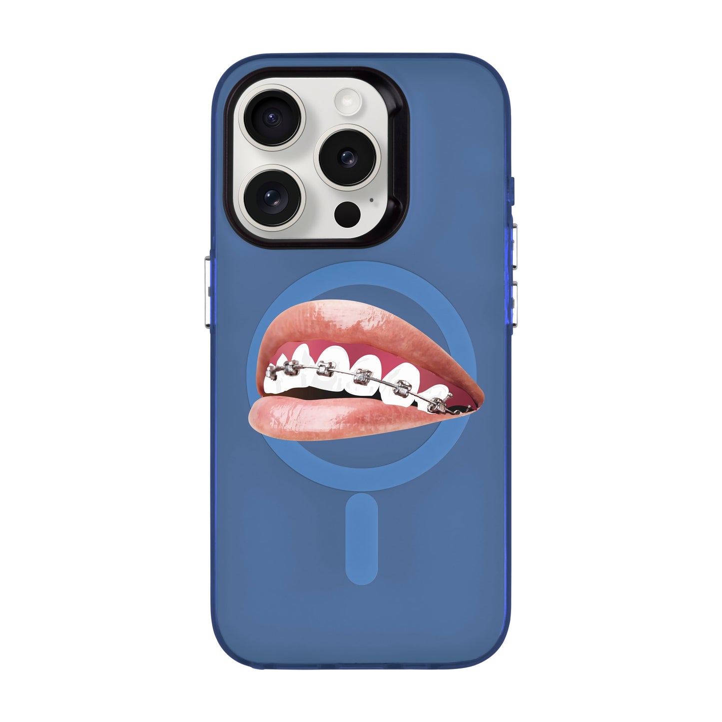 ORTHODONTIST-iPhone 15 Pro Hold Kılıf MagSafe Özellikli
