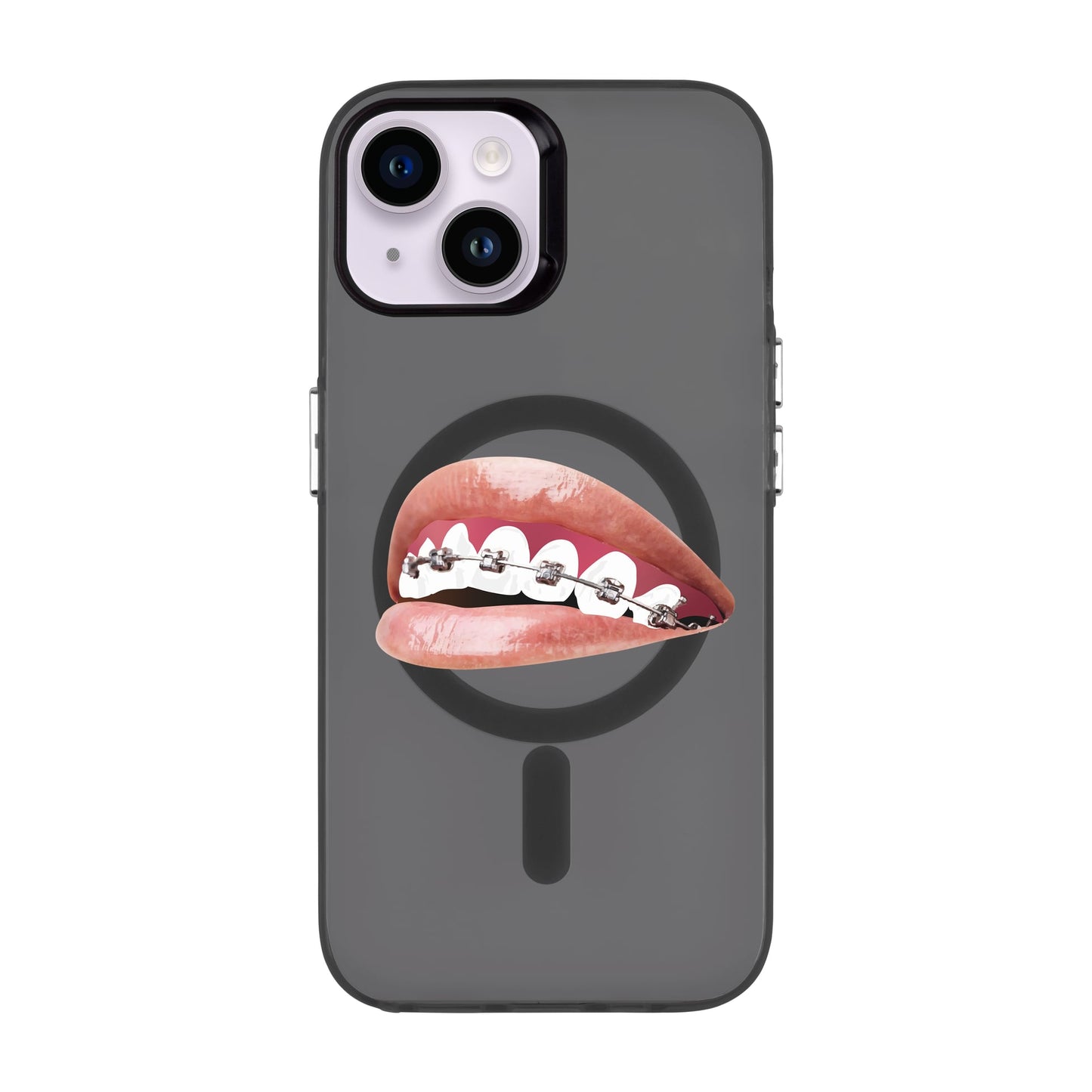 ORTHODONTIST-iPhone 14 Hold Kılıf MagSafe Özellikli