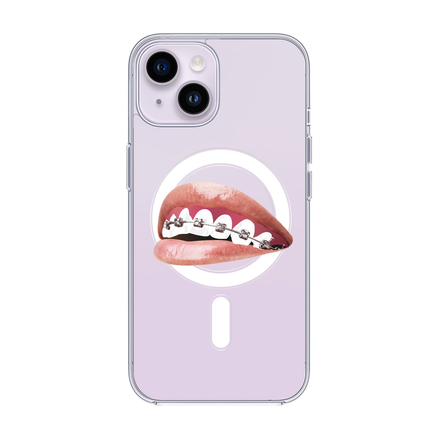 ORTHODONTIST-iPhone 13 Pro Max Solid Kılıf MagSafe Özellikli