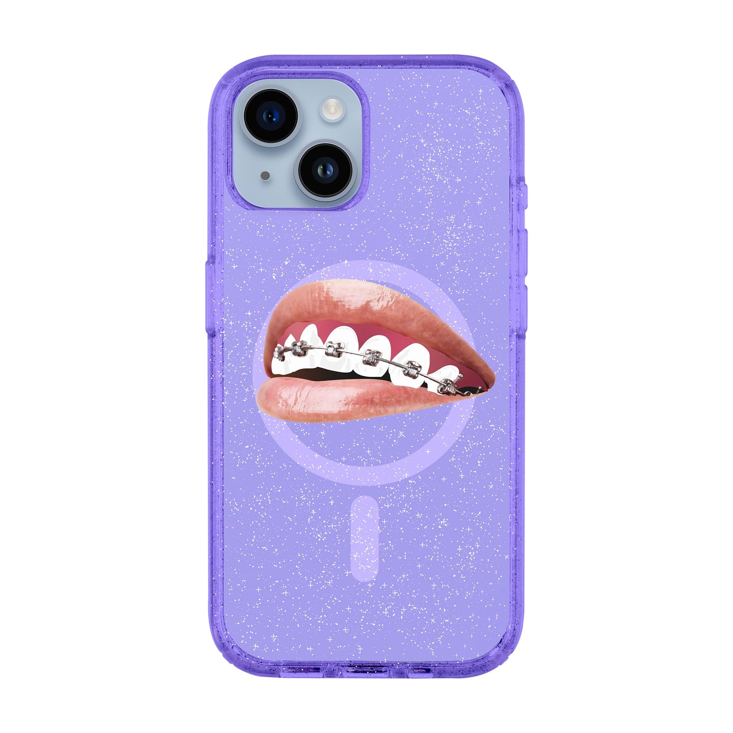 ORTHODONTIST-iPhone 13 Shiny Kılıf MagSafe Özellikli
