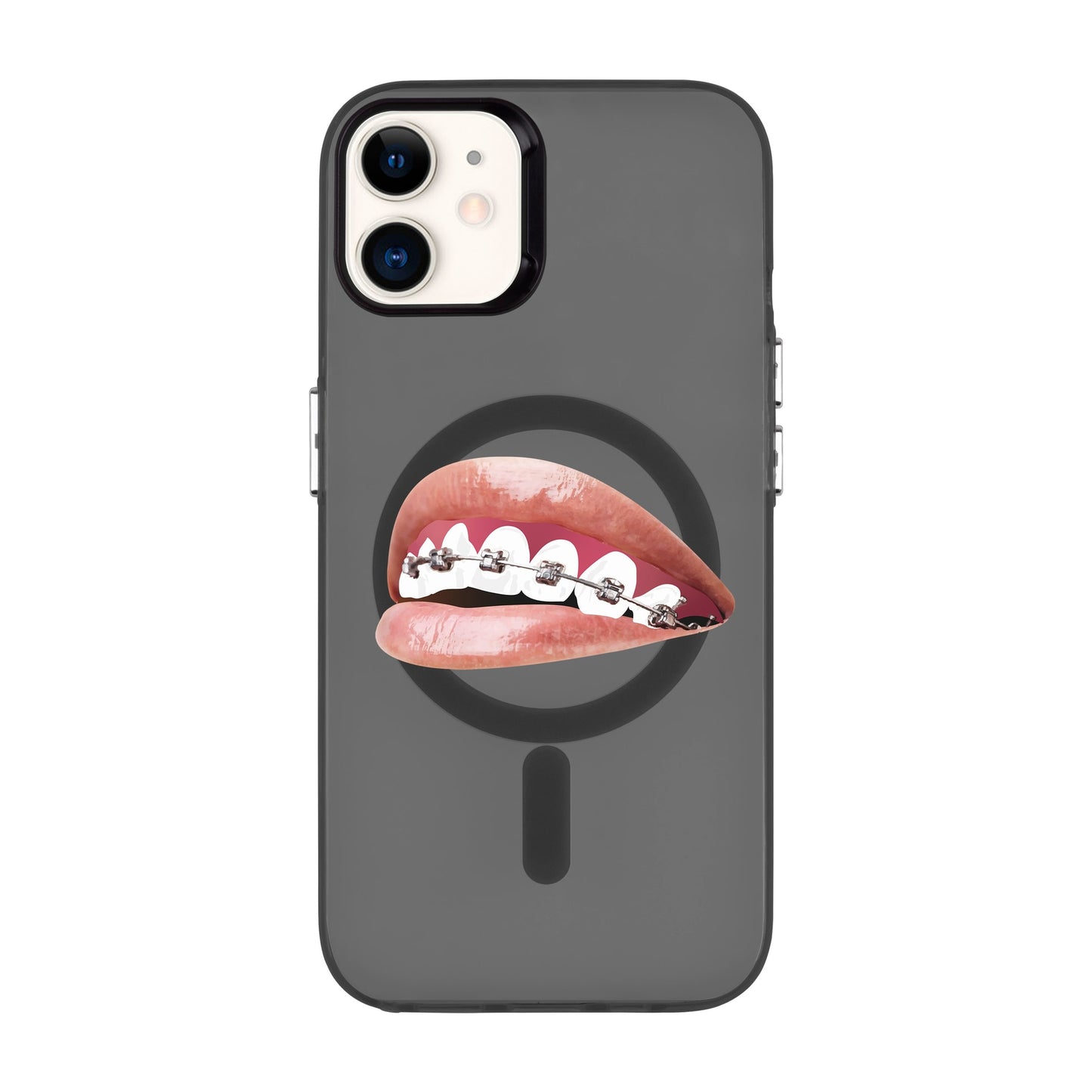 ORTHODONTIST-iPhone 11 Hold Kılıf MagSafe Özellikli
