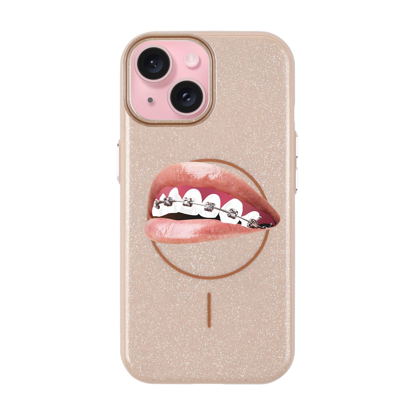 ORTHODONTIST-iPhone 15 Plus Radiant Kılıf MagSafe Özellikli