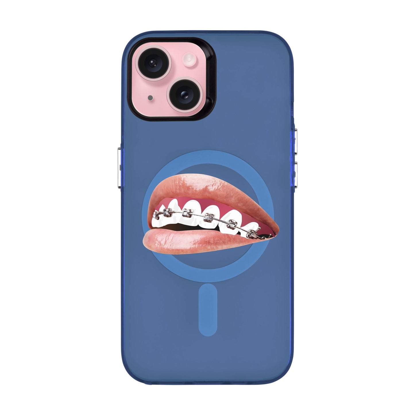 ORTHODONTIST-iPhone 15 Hold Kılıf MagSafe Özellikli