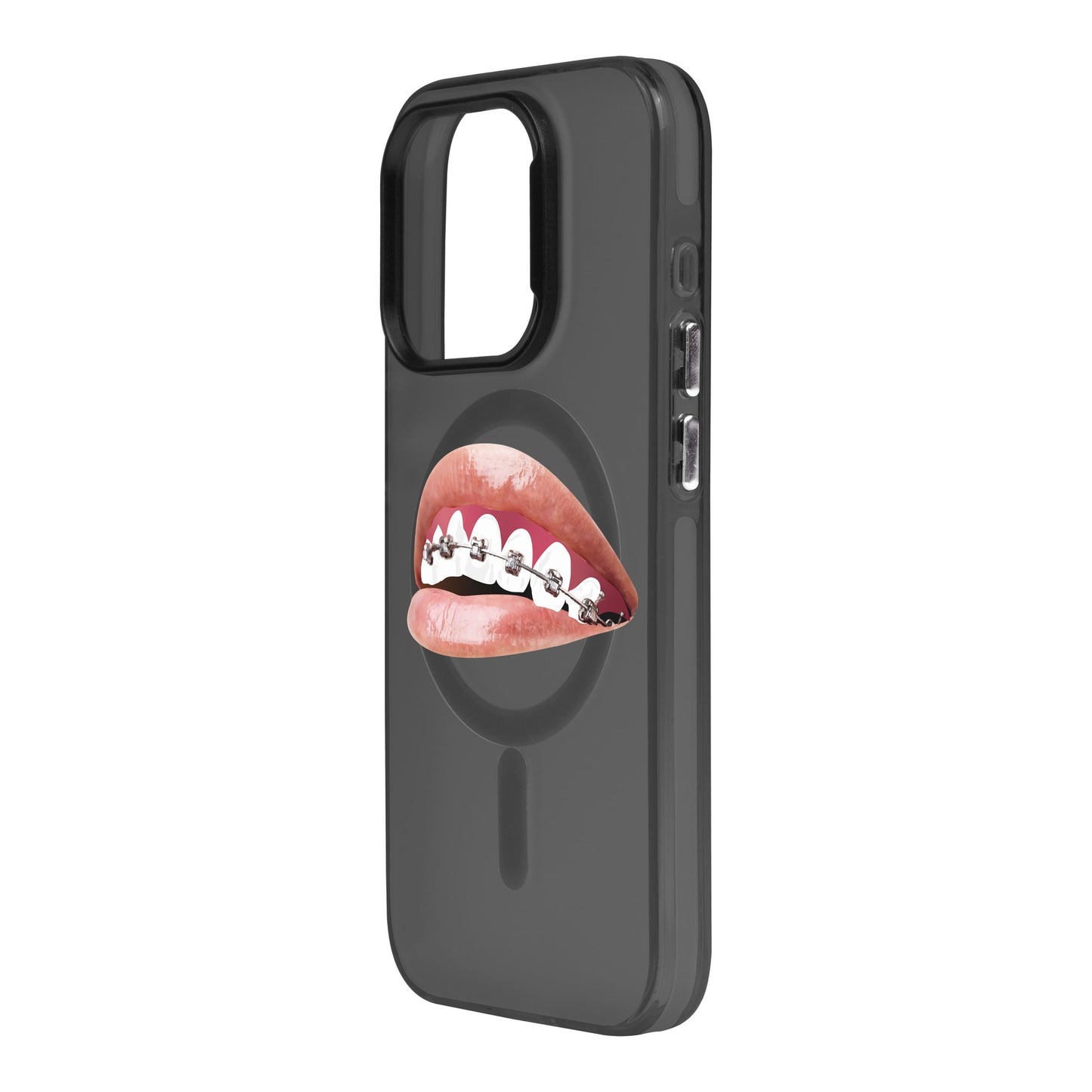 ORTHODONTIST-iPhone 15 Pro Hold Kılıf MagSafe Özellikli