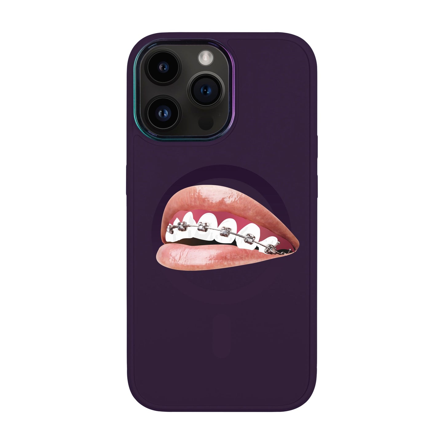 ORTHODONTİST-iPhone 14 Pro Max Vigor Kılıf MagSafe Özellikli