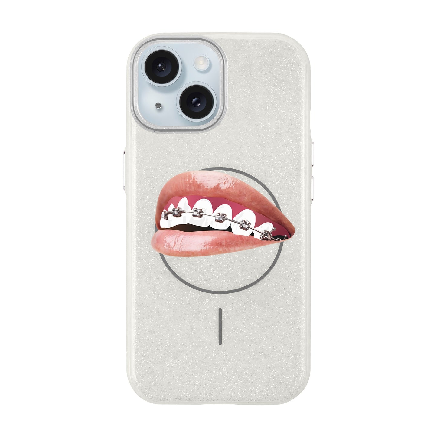 ORTHODONTIST-iPhone 15 Plus Radiant Kılıf MagSafe Özellikli
