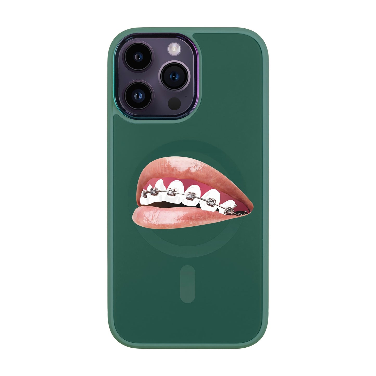 ORTHODONTİST-iPhone 14 Pro Max Vigor Kılıf MagSafe Özellikli