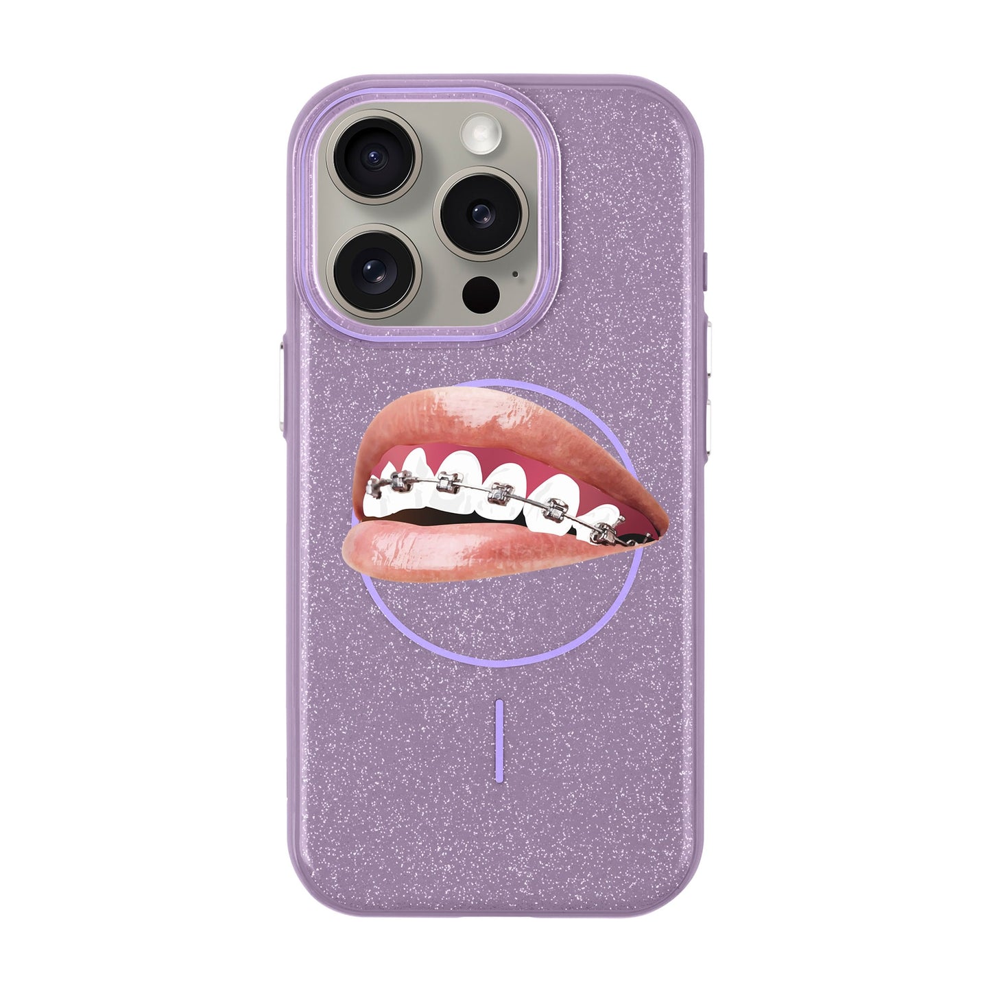 ORTHODONTIST-iPhone 15 Pro Radiant Kılıf MagSafe Özellikli