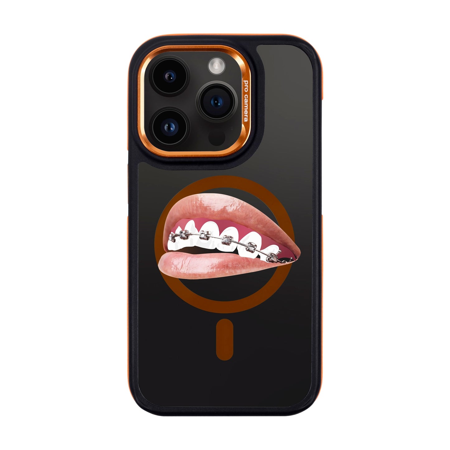 ORTHODONTIST-iPhone 14 Pro Dark Kılıf MagSafe Özellikli