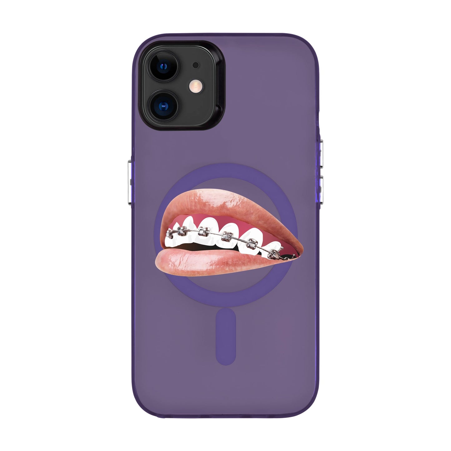 ORTHODONTIST-iPhone 11 Hold Kılıf MagSafe Özellikli