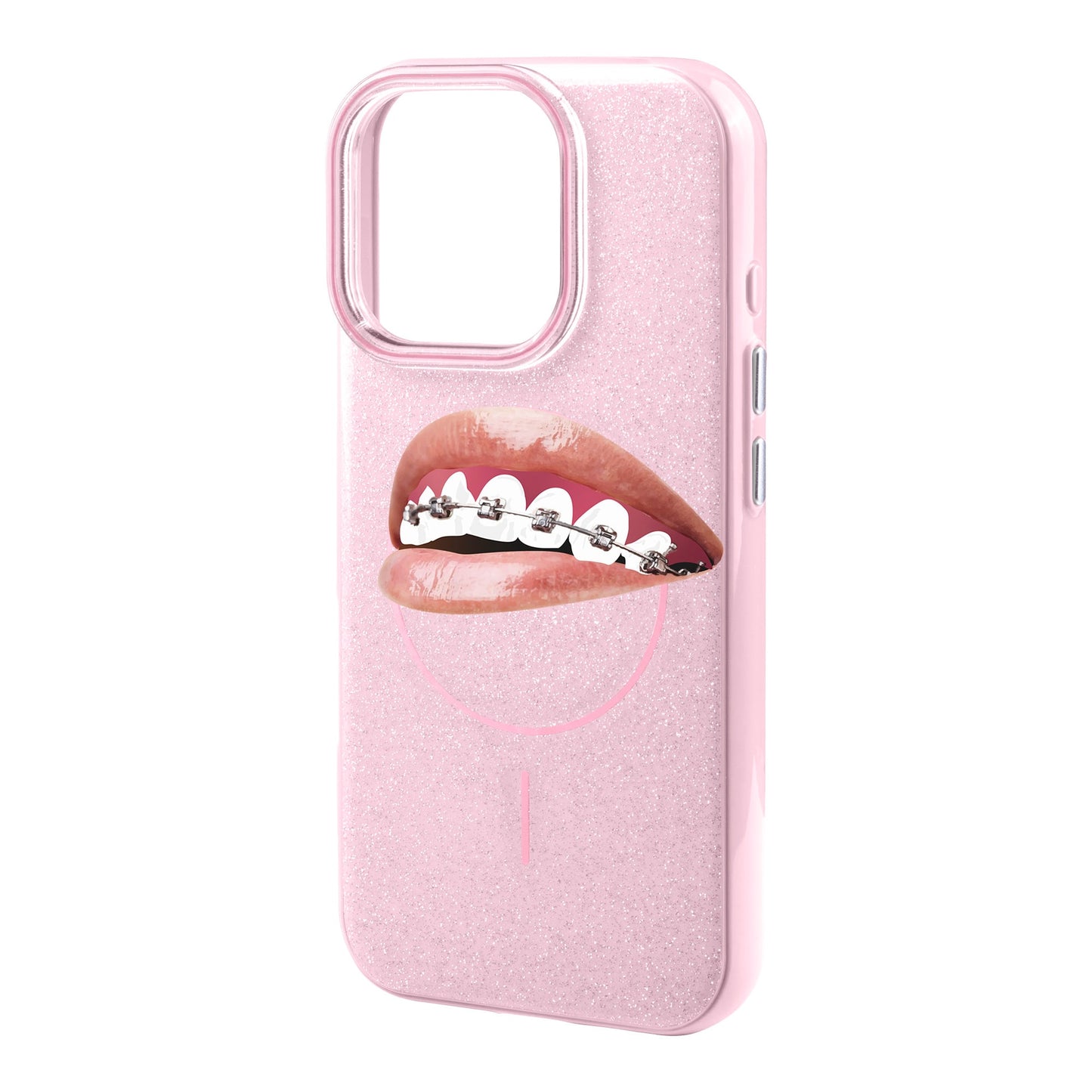 ORTHODONTIST-iPhone 16 Pro Max Radiant Kılıf MagSafe Özellikli