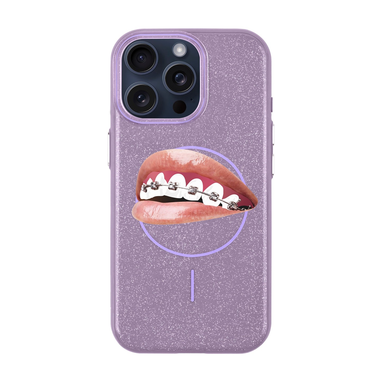 ORTHODONTIST-iPhone 15 Pro Max Radiant Kılıf MagSafe Özellikli