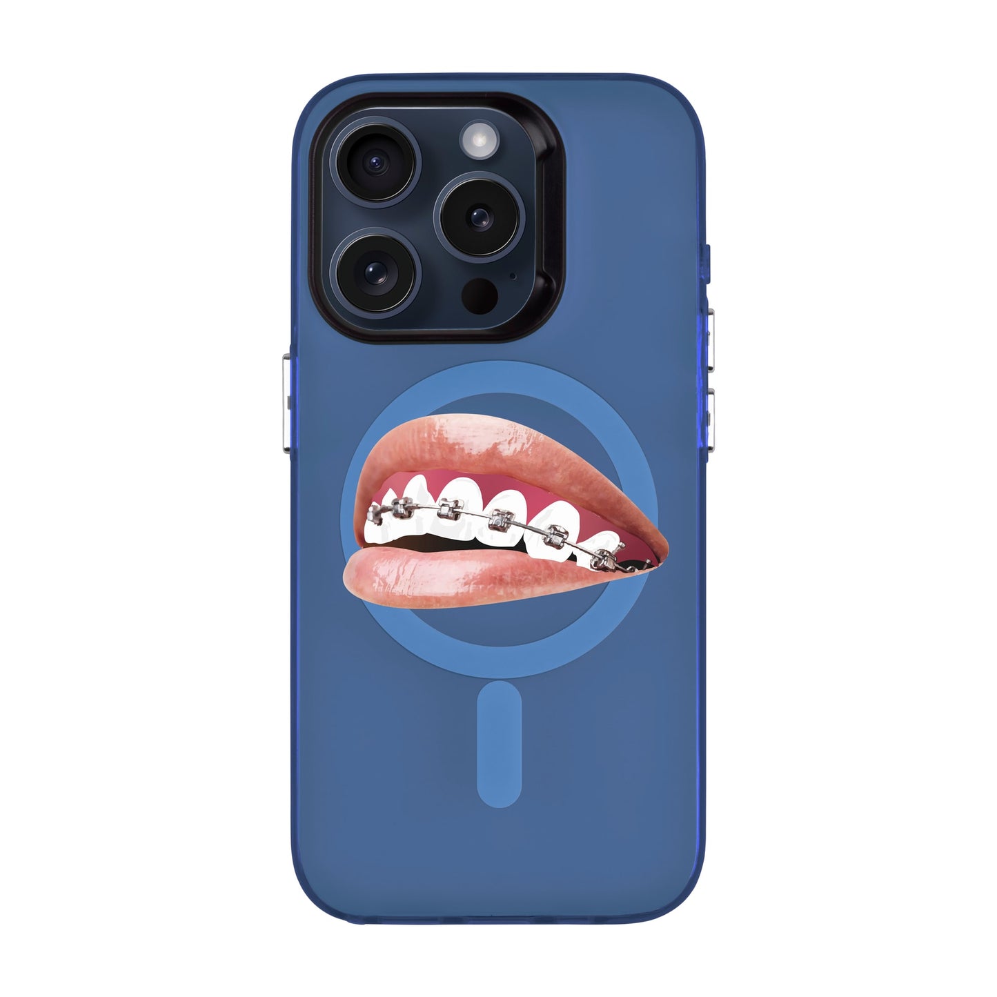 ORTHODONTIST-iPhone 15 Pro Hold Kılıf MagSafe Özellikli