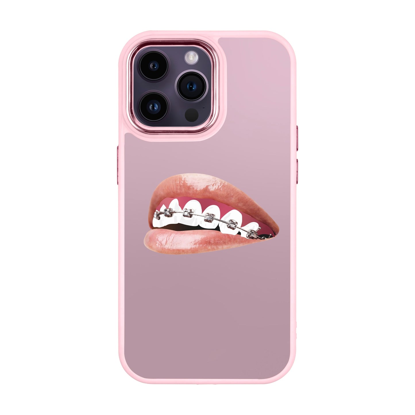 ORTHODONTIST-iPhone 14 Pro Max Proof Kılıf