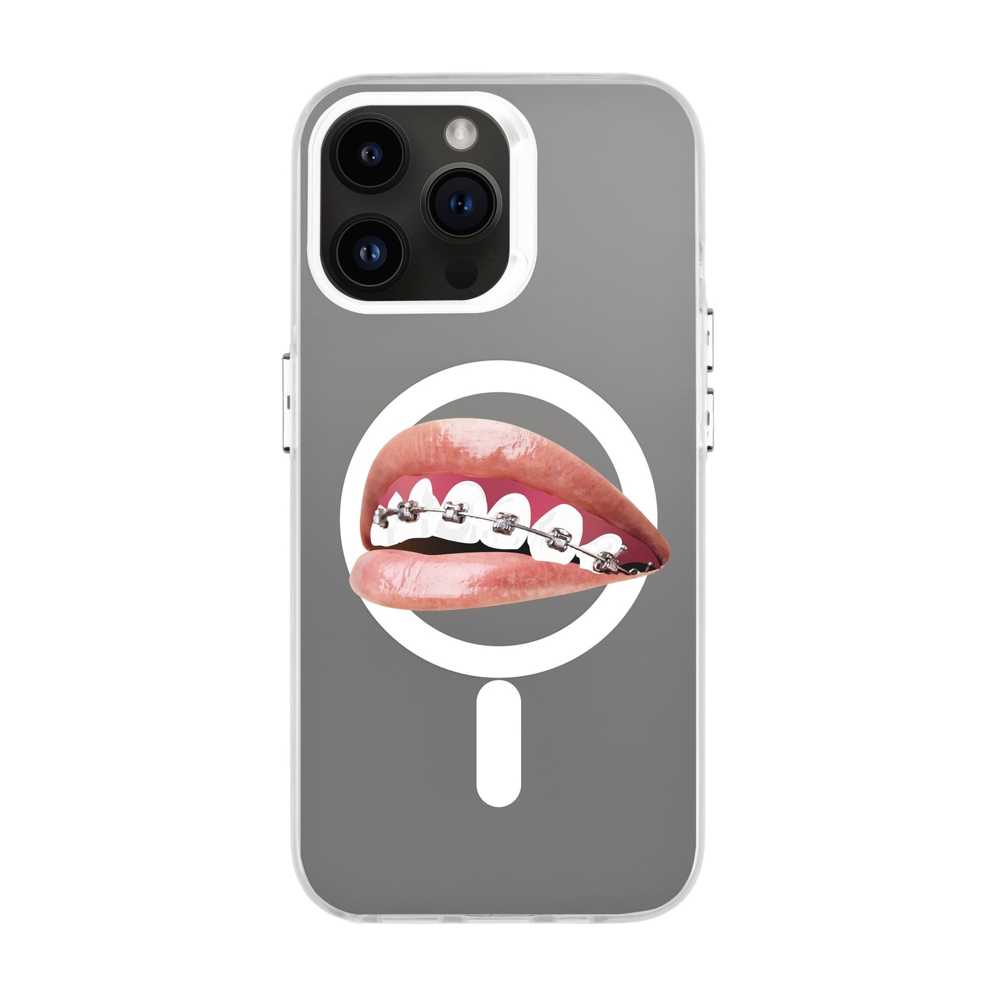 ORTHODONTIST-iPhone 14 Pro Max Hold Kılıf MagSafe Özellikli